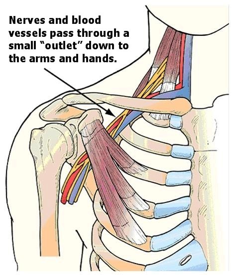 Structures and Spaces  Center for Thoracic Outlet Syndrome