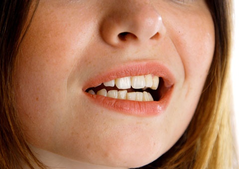 What you don’t know about clenching and grinding your teeth