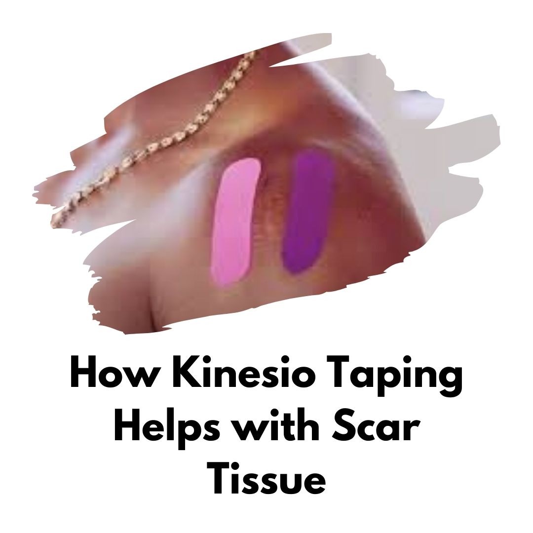 How Kinesio Taping Helps with Scar Tissue