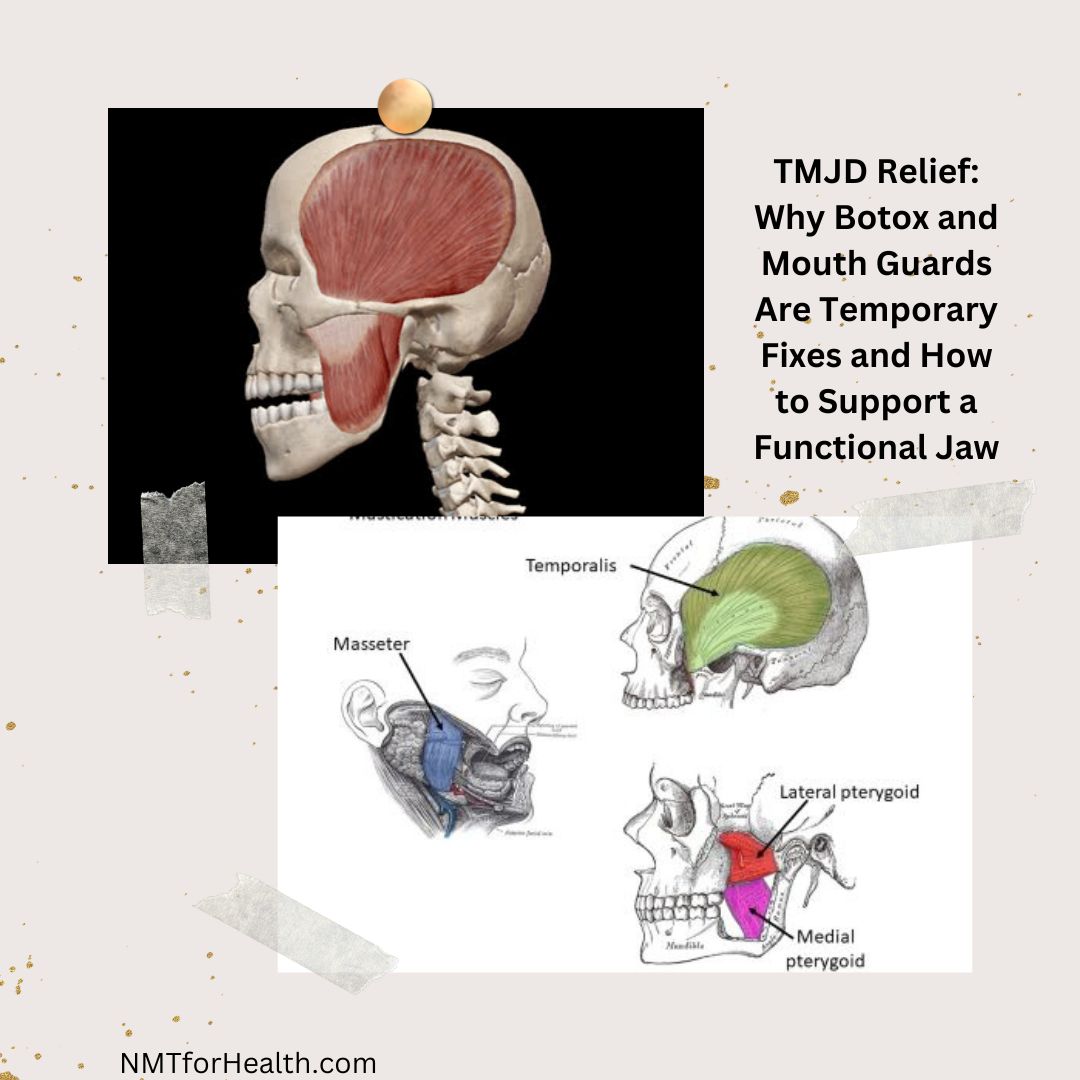 TMJ & TMD Relief: Why Botox and Guards Fall Short